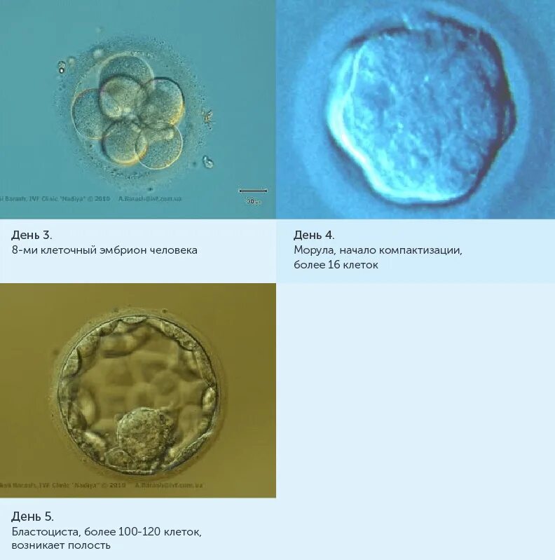 Бластоцисты в кале под микроскопом. Цисты бластоцисты хоминис. Blastocystis hominis трофозоиты. Бластоциста в калле. Бластоцисты кал.