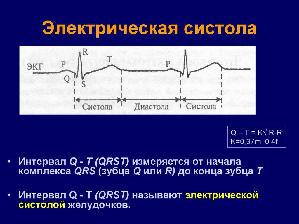 Удлиненное qt на экг. Интервал qt на ЭКГ норма. Интервал qt систола желудочков. ЭКГ нормальные показатели qt. Интервал qt на ЭКГ электрическая систола.