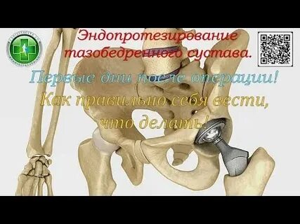 Шов после операции эндопротезирования тазобедренного сустава