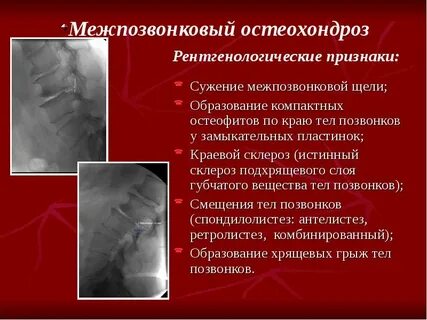 Ст х пр