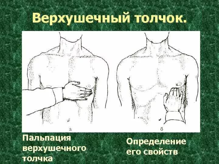 Характеристика нормального верхушечного толчка. Методика пальпации верхушечного толчка. Верхушечный толчок не определяется при. Методика пальпации верхушечного толчка. Верхушечный толчок сердца определяется в норме.