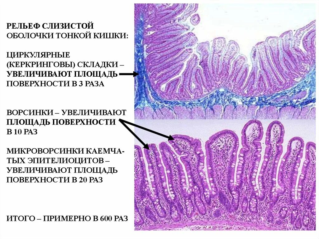 Слизистая оболочка 12 кишки. Микроворсинки кишечника гистология. Слизистая оболочка толстой кишки гистология. Слизистая оболочка Толстого кишечника гистология. Складка толстой кишки гистология.