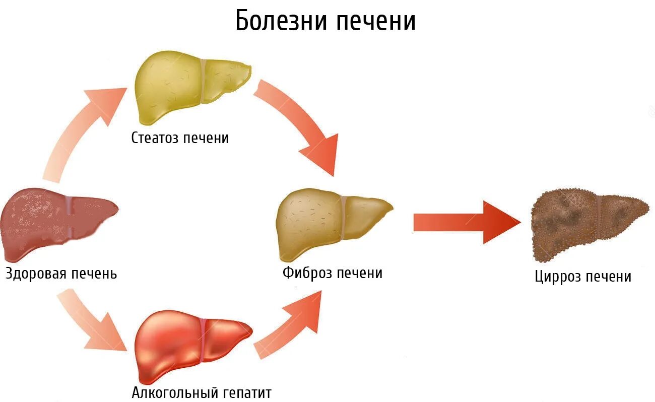 Вылечил печень форум