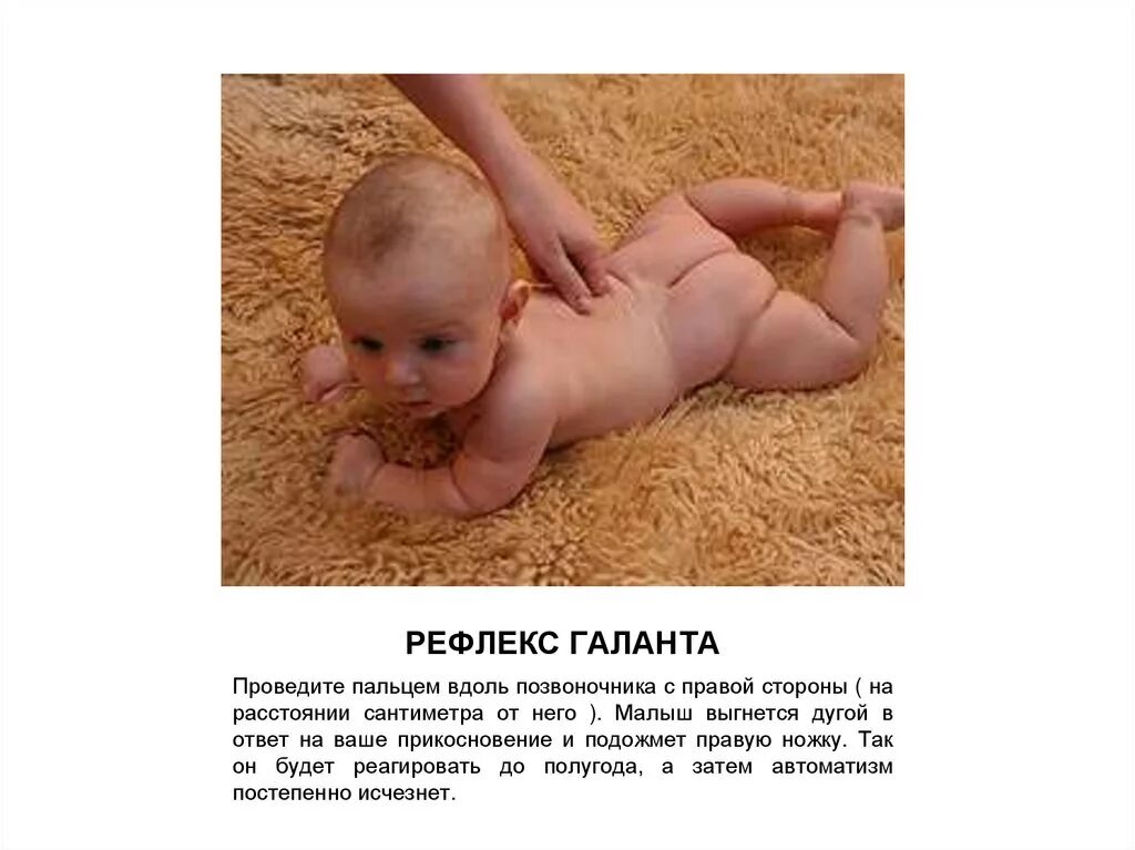 Рефлекс галанта у новорожденных. Рефлекс галанта у новорожденных. Хоботковый рефлекс у новорожденных. Галанта рефлекс новорожденного. Спинальный рефлекс галанта.