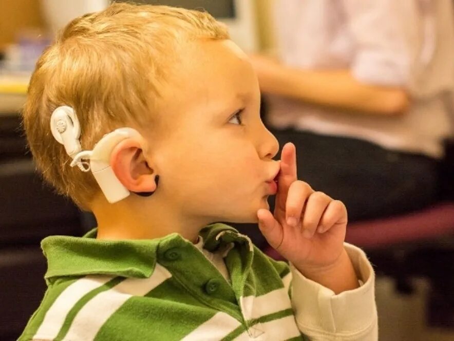 Дети с нарушением слуха.. Слуховой аппарат для детей. Глухие и слабослышащие дети. Дети с кохлеарными имплантами.. Нарушения слуховых функций