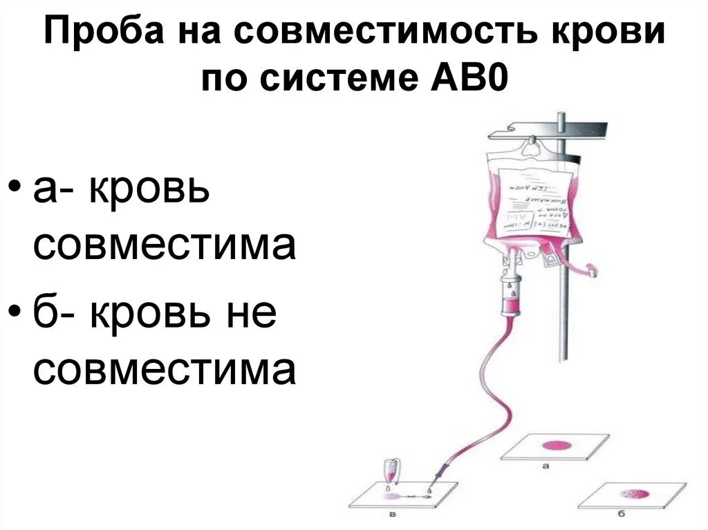 Проведение проб на совместимость при переливании крови. Проба на совместимость крови по системе АВО. Проба на индивидуальную совместимость по системе ав0. Проба на совместимость крови донора и реципиента. Пробы на совместимость при переливании крови