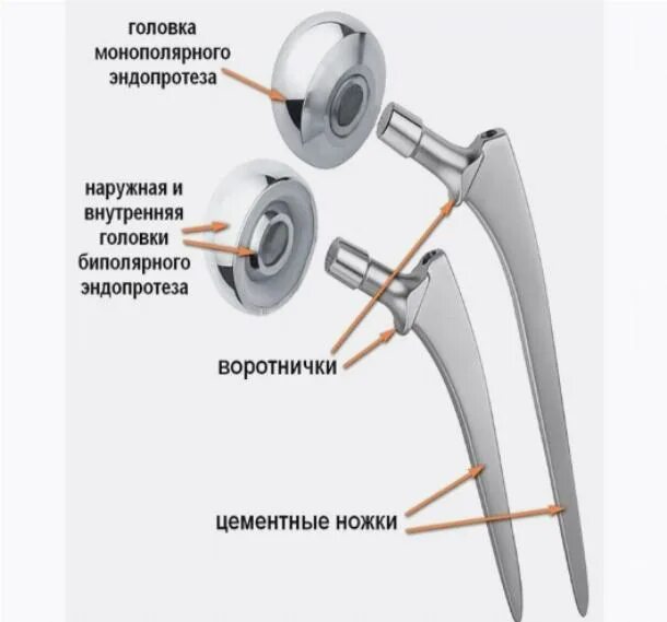 эндопротез genesis ii. ножка zimmer wagner. ревизионная ножка зиммер. тазобедренный сустав фирмы zimmer. эндопротез ecofit фирмы implantcast.