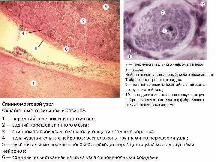 Спинномозговой чувствительный узел