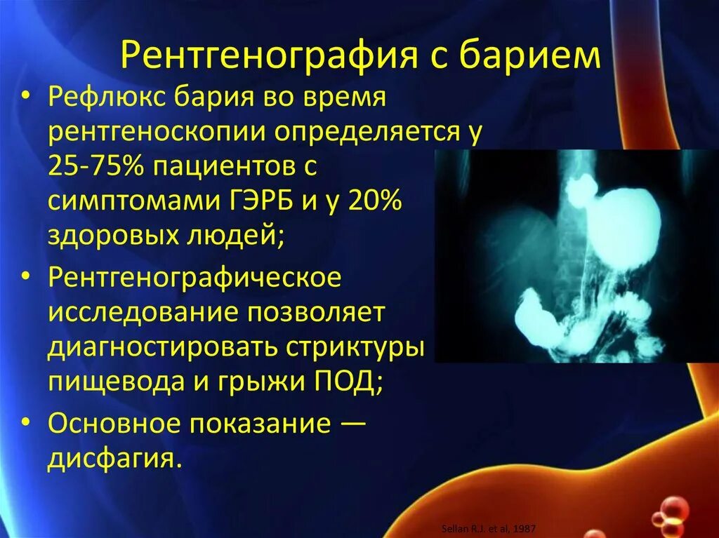 Рентгеноскопия пищевода подготовка