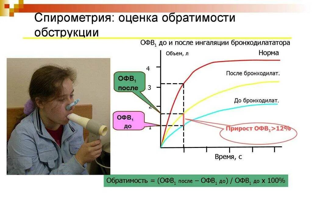 Фвд что это за обследование. Оценка функции внешнего дыхания (ФВД):. Спирометрия при бронхиальной астме показатели. Показатели спирометрии в норме у детей. Спирометрия спирография нормы.