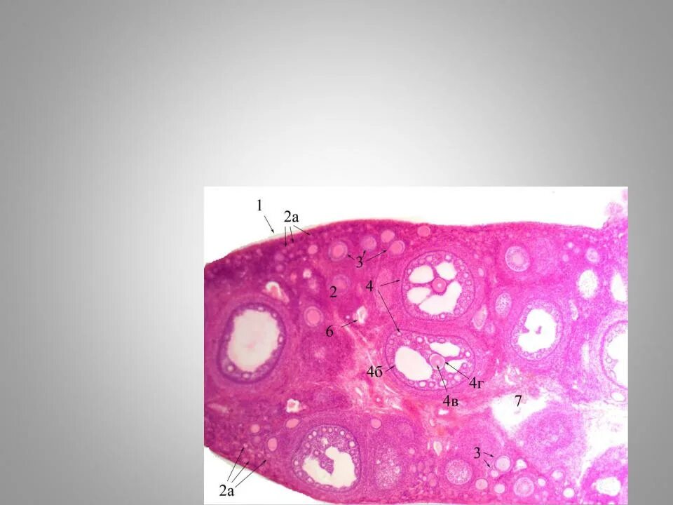 Мозговое вещество яичника. Корковое вещество яичника. Яичник гематоксилин эозин. В мозговом веществе яичника расположены. Фолликулы 6 мм