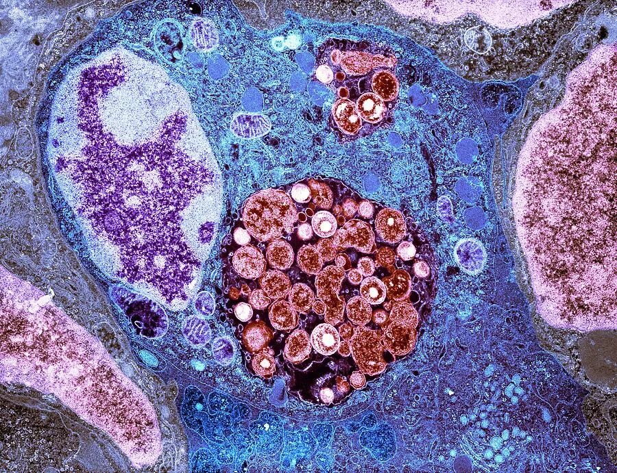 Хламидия трахоматис под микроскопом. Хламидии микрофотография. Хламидии микроорганизмы.