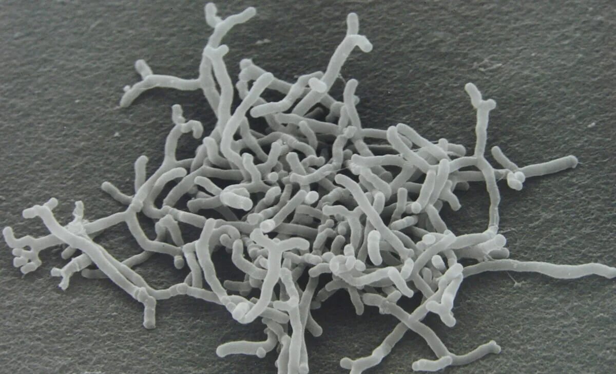 Бифидобактерии 5. Бифидобактерии bifidum. Бифидобактерии бифидум микроорганизмы. Бифидобактерии лонгум. Бактерии рода Bifidobacterium longum.