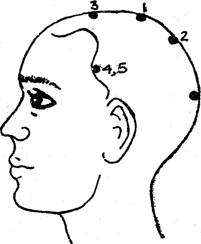 Точки шум в ушах. Точка при головокружении рефлексотерапия. Точки на голове для массажа. Точечный массаж головы. Точки на затылке для массажа.