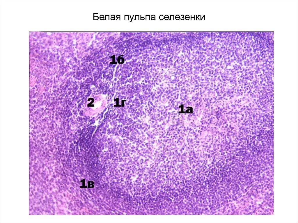 Ткань селезенки. Белая пульпа селезенки гистология. Трабекулярная Вена селезенки. Белая и красная пульпа селезенки гистология. Красная пульпа селезенки гистология.