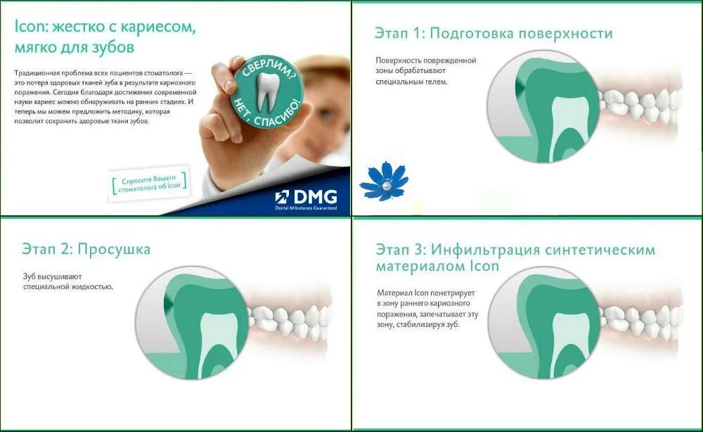 Чувствительность зубов после лечения. Инфильтрация кариеса методом "icon". Icon стоматология методика. Icon система в стоматологии методика. Лечение кариеса эмали методом инфильтрации (icon).