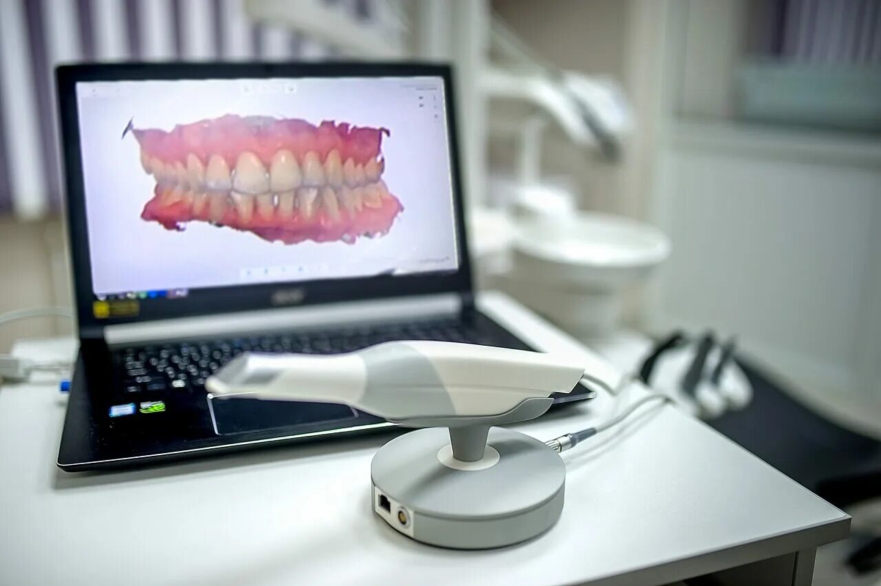 3d слепки зубов. 3d печать в стоматологии. сканирование слепков. биометрический сканер отпечатков пальцев. внутриротовой сканер 3shape.