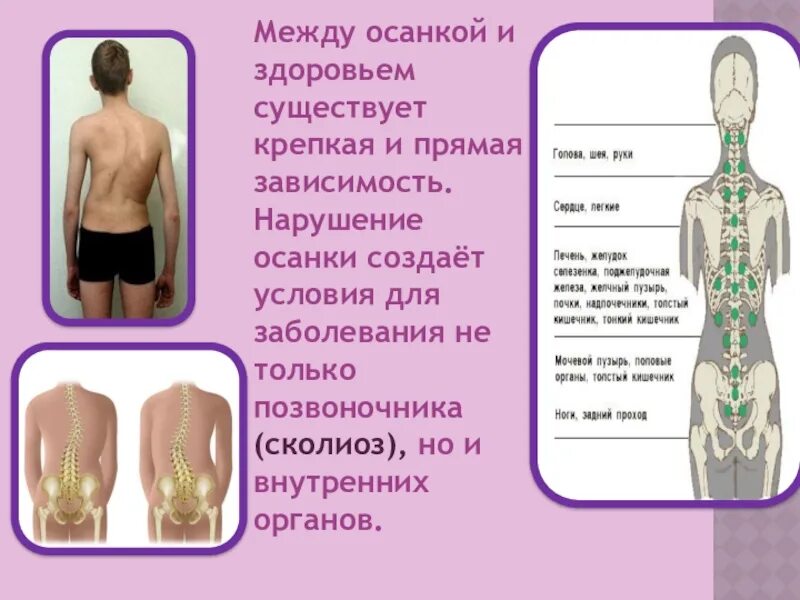 Влияние осанки на организм кратко. Влияние осанки на организм. Влияние правильной осанки на здоровье. На что влияет неправильная осанка. Влияние осанки на здоровье человека.