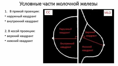 Верхний левый квадрант молочной железы