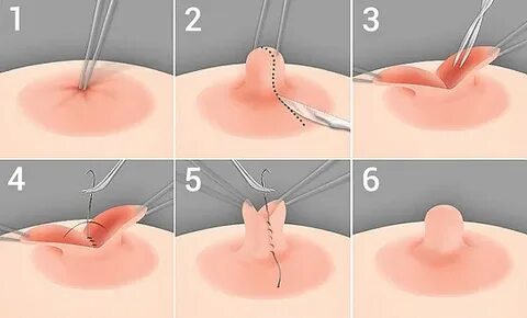 Мини юбка киген шешен әйел