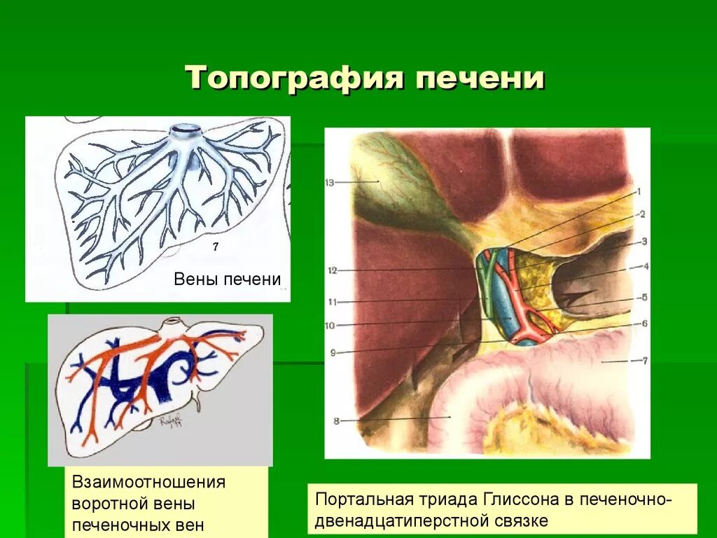 Триада печени. Топография печени скелетотопия. Скелетотопия печени топографическая анатомия. Триада Глиссона печень. Топография печени синтопия.