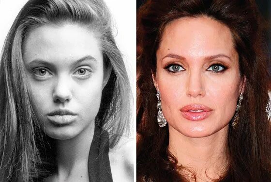 Pin by Pinner on Angelina Jolie II Angelina jolie, Bernadette peters, Cosmetic s