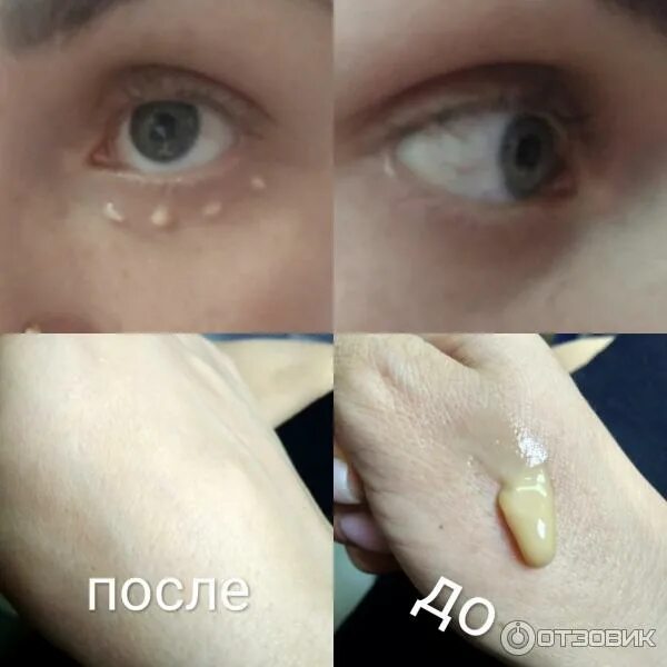 Отзыв о Крем Фитосила-Биос "Клирвин" для ухода за кожей Эффективный.