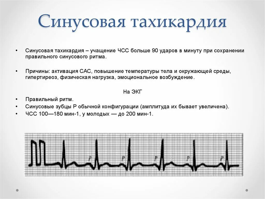 Сильное сердцебиение температура