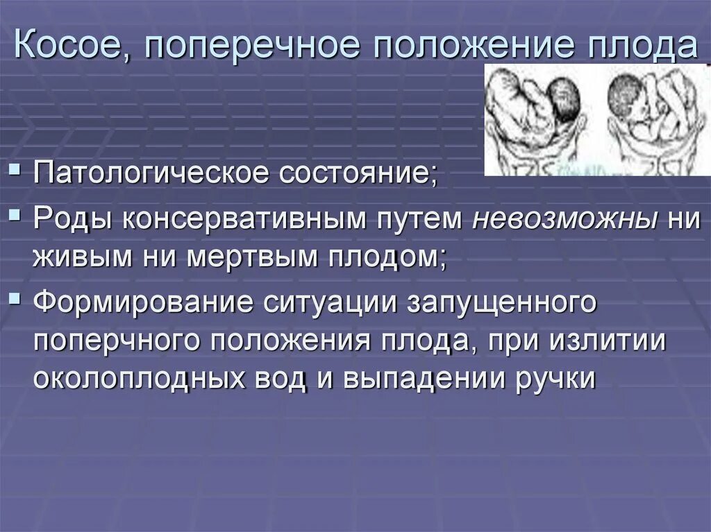 Запущенное положение плода. Поперечное положение плода в 30 недель беременности. Поперечные и косые положения плода. Поперечное и косое положение плода. Причины поперечного положения плода.