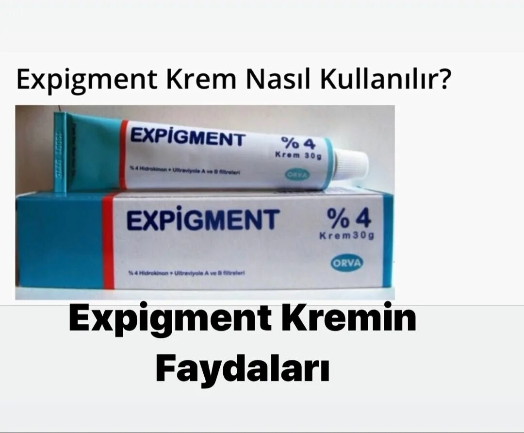 Крем expigment 4 отзывы. Expigment 4% крем. Мазь expigment. Экспигмент крем 4 в аптеке. Турецкий отбеливающий крем expigment.