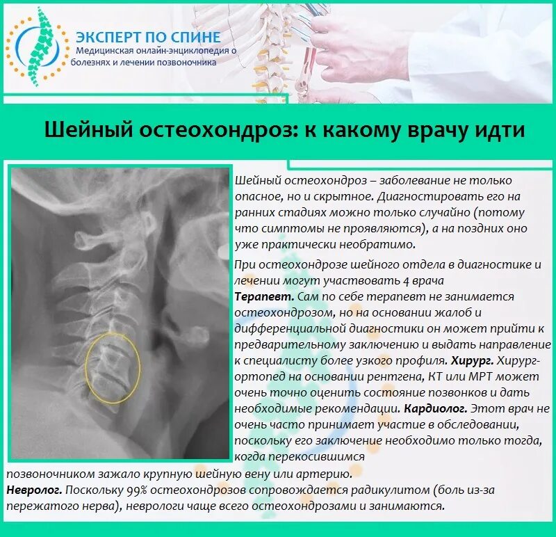 Лечение острого остеохондроза. Остеохондроз шейного отдела. Острохондрозшейного отдела. Шейный остеохондроз симптомы. Остеохондроз шейного отдела симптомы.