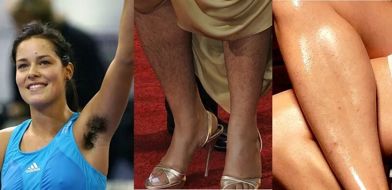 почему у женщин темное между ног