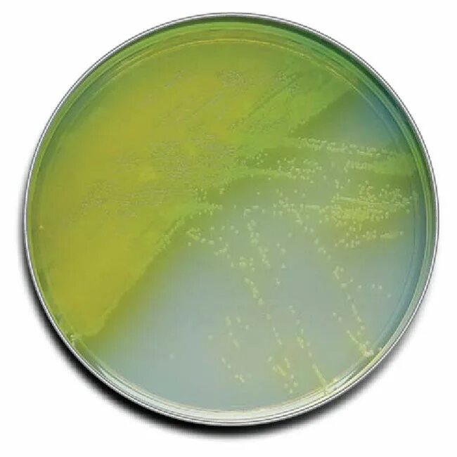 Ба агар. Pseudomonas aeruginosa цетримидный агар. Малахитовый агар синегнойная палочка. Pseudomonas aeruginosa микробиология. Pseudomonas aeruginosa на цетримидном агаре.