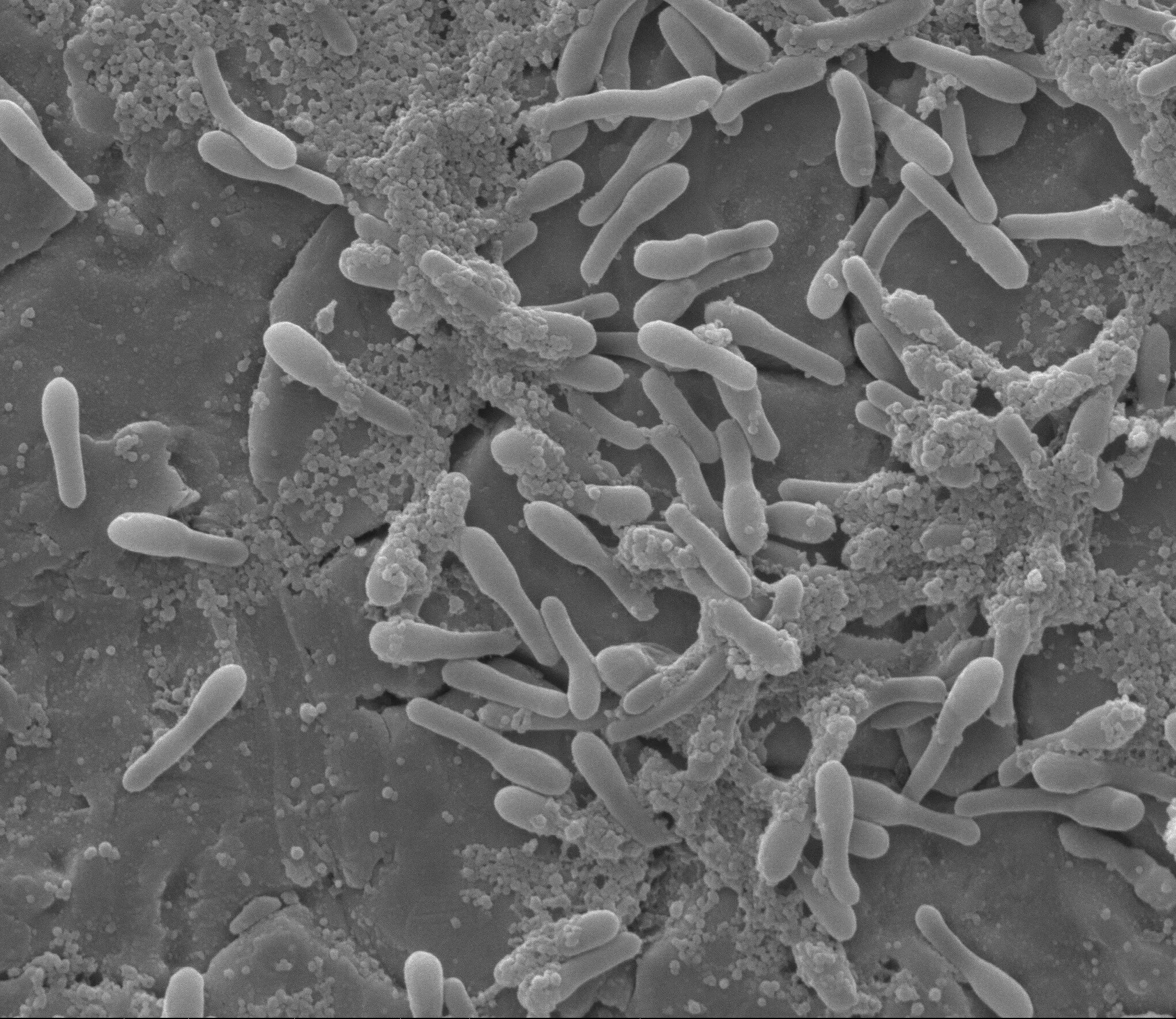 Бактерии Bacillus subtilis. Бактерия Сенная палочка. Bacillus subtilis штамма 534. Bacillus subtilis микроскопия.