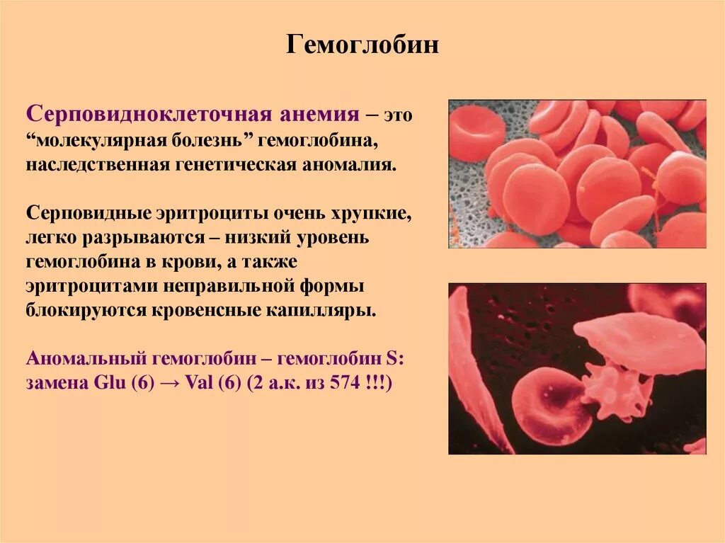 Анемия как поднять. Гемоглобин серповидноклеточная анемия. Гемоглобин человека с серповидноклеточной анемии. Серповидноклеточная анемия эритроциты. Гемоглобин и Эритройит.