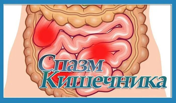 Спастическое сокращение кишечника. Спазм кишечника симптомы. Спастические боли в кишечнике. Колики в животе у взрослых лечение