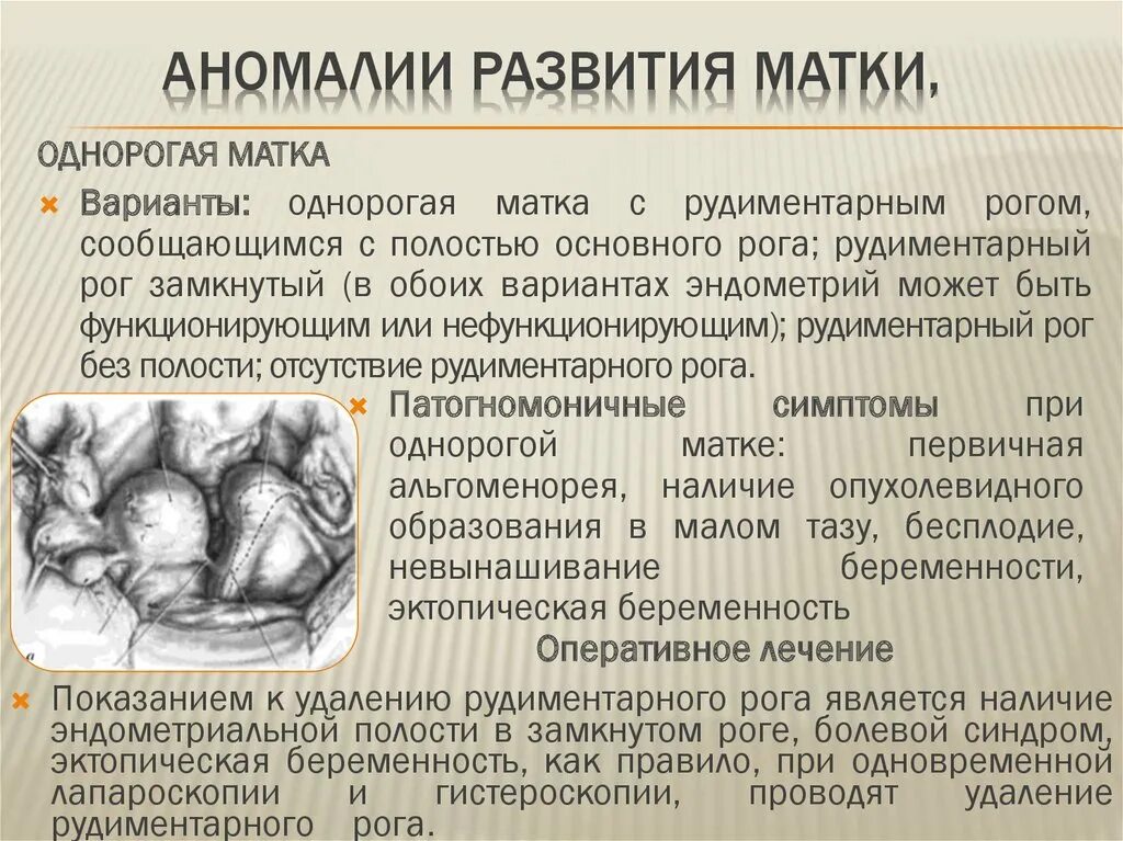 Аномалия развития матки однорогая. Однорогая матка с замкнутым рудиментарным рогом. Рудиментарный Рог матки.