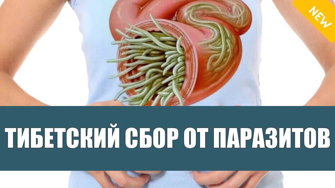 Очищение организма от паразитов. Очищение организма от глистов и паразитов. Очистить организм от паразитов. Очищение организма от паразитов и шлаковых. Очистки организма от паразитов