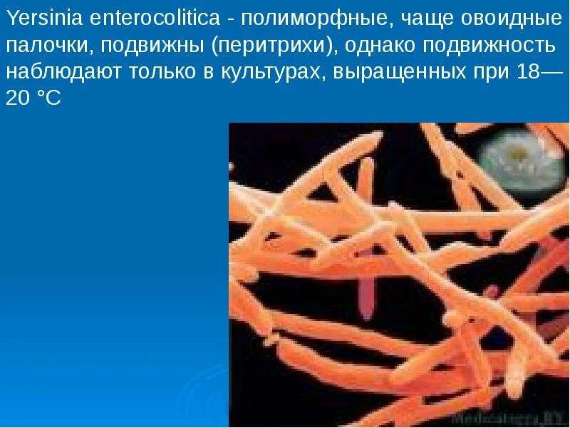 Полиморфно ядерный лейкоцит. Полиморфные палочки что это такое. Полиморфная палочка. Анаэробные микроорганизмы грамположительные палочки. Полиморфные палочки что это такое.