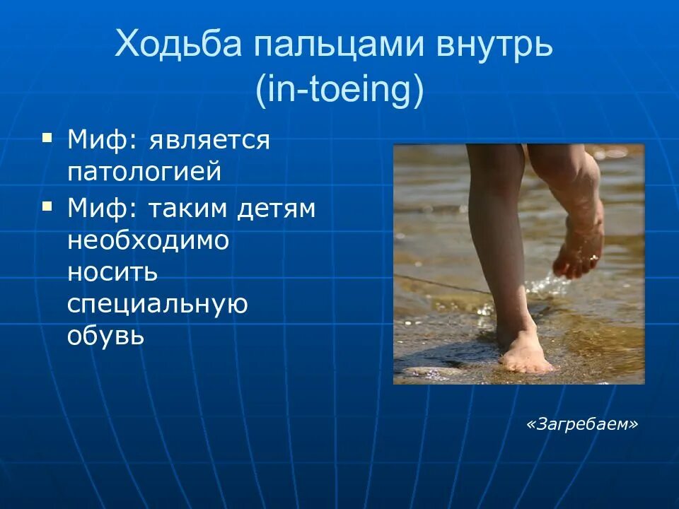 Ноги внутрь при ходьбе. Стопы внутрь при ходьбе. ребенок при ходьбе загребает одной ногой. ходьба на пальцах.