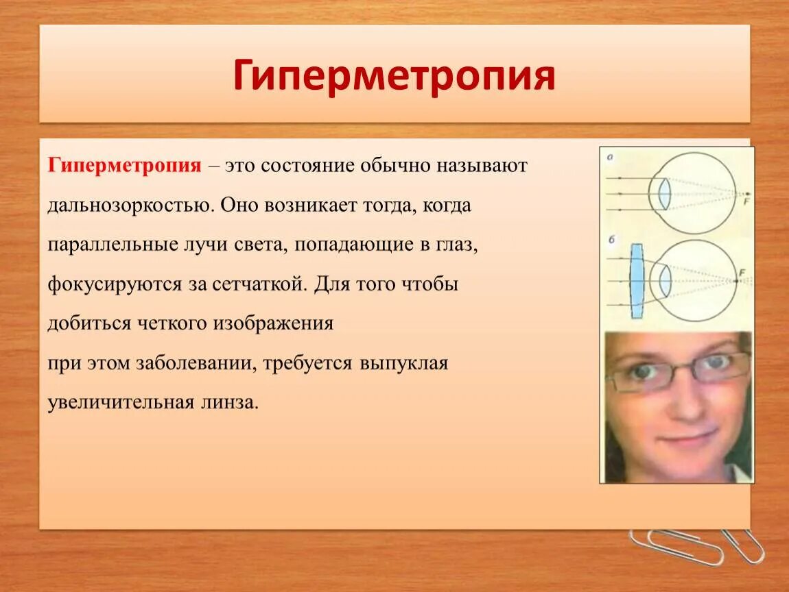 Операция при дальнозоркости. Гиперметропия. Что такое гиперметропия глаз слабой степени. Гипертромитрия слабой степени.