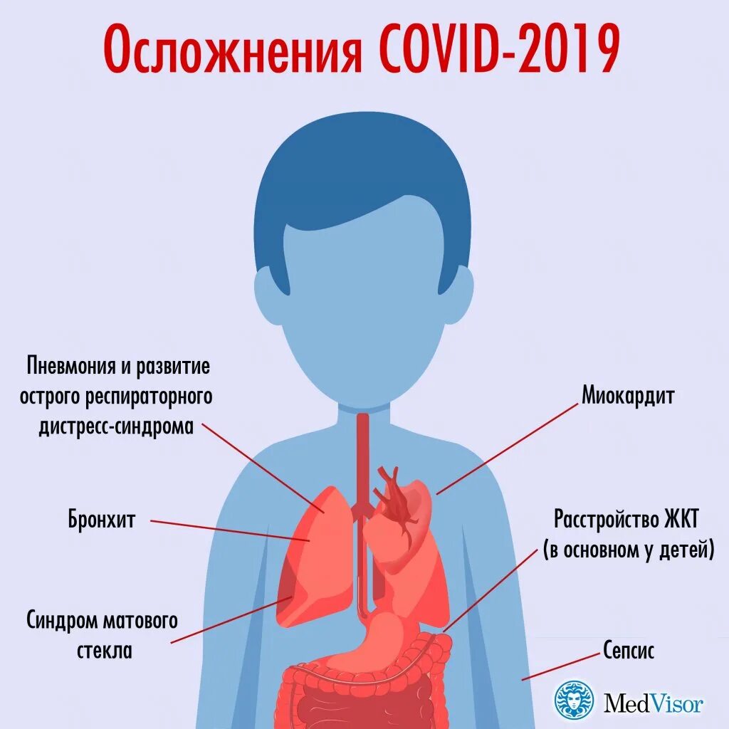 Какие осложнения могут возникнуть после. О́сложнениякороновируса. Осложнения коронавируса. Короновирусная инфекция осложнения. Коронавирус последствия для организма.