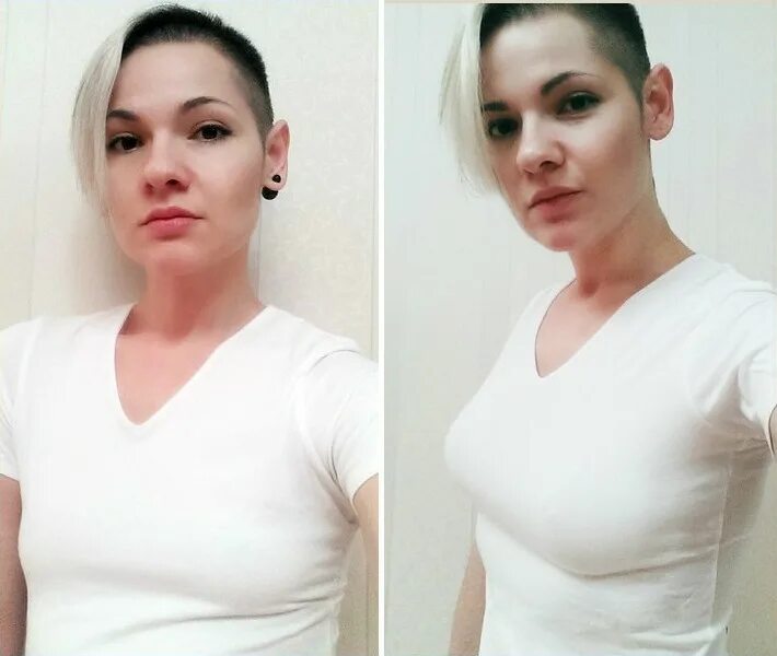 маммопластика (увеличение груди). маммопластика иркутск. грудь и зона декольте. пластическая операция на грудь. пластический хирург грудь.