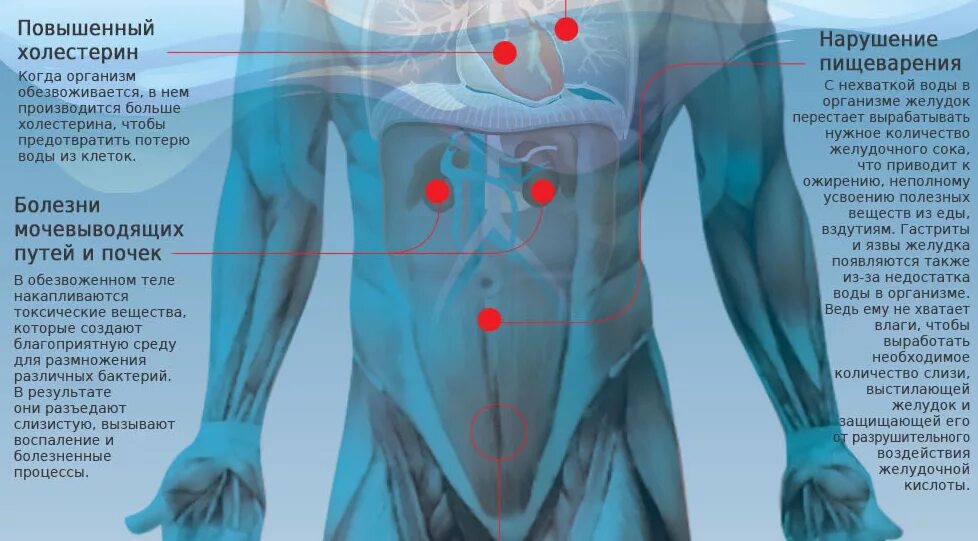 Как действует вода на организм. Вода в организме. Нехватка воды в организме. Вода в теле человека. Признаки дефицита воды.