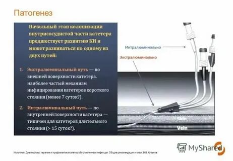 Инфекция через катетер