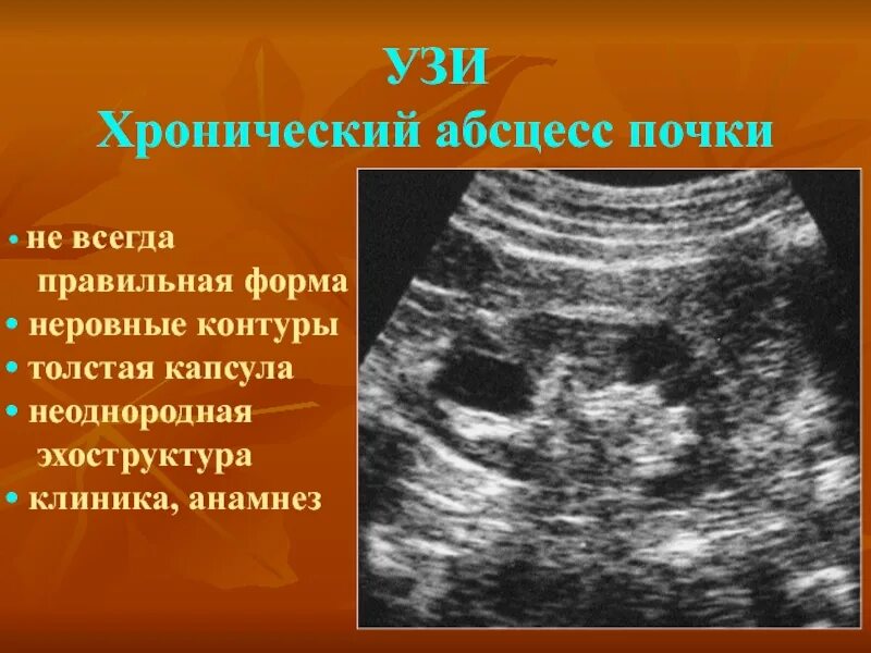 Селективная ангиография. Почка члс на узи норма. Анатомия почки кт. Почки контур. Неровный контур почек.