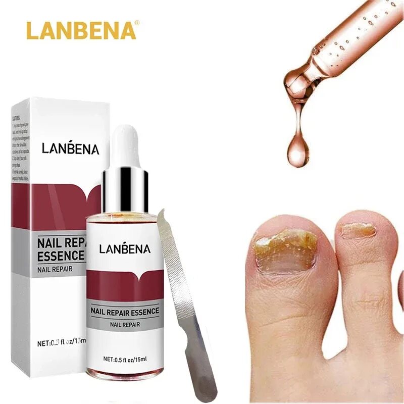 LANBENA сыворотка для ногтей. Ланбена для ногтей от грибка. LANBENA Nail Repair Essence от грибка ногтей. Средство от грибка ногтей LANBENA Nail Repair Essence 15 ml.