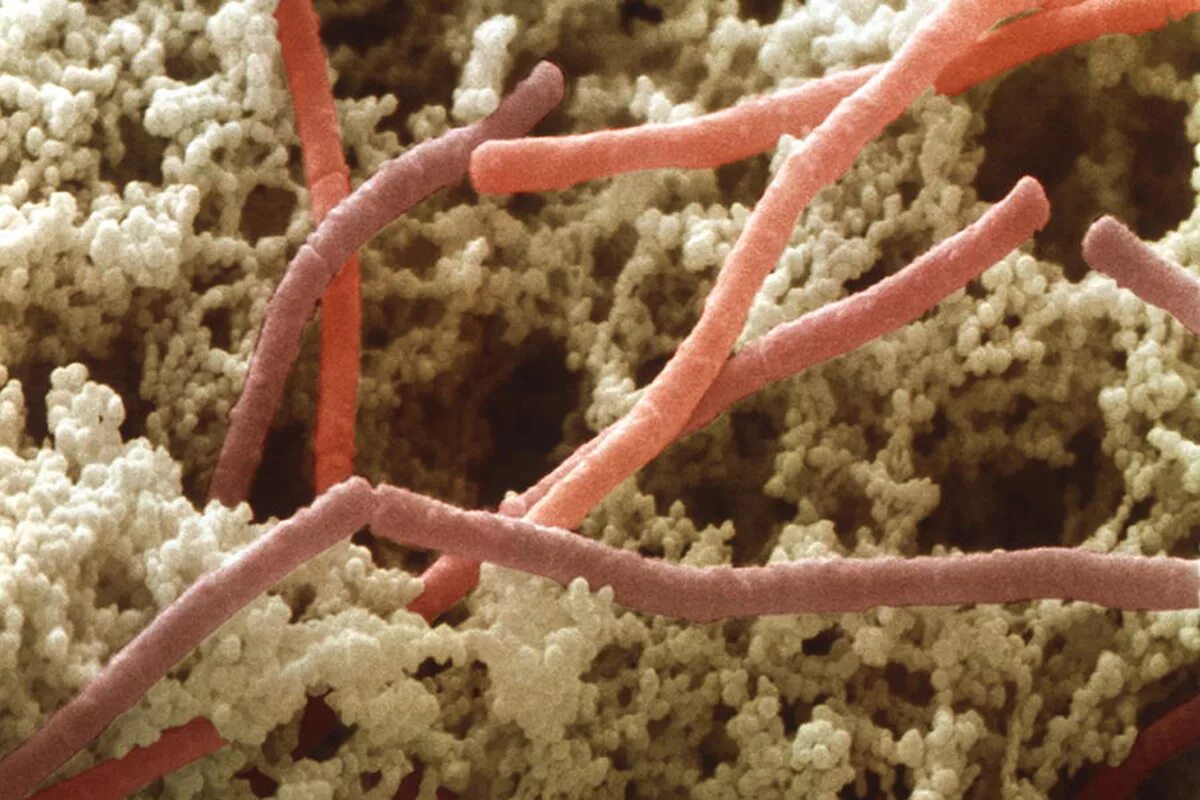 Микроорганизмы в пищевой промышленности. Болгарская палочка Lactobacillus bulgaricus. Болгарская палочка (Lactobacterium bulgaricum). Болгарская палочка Мечникова. Термофильный стрептококк под микроскопом.