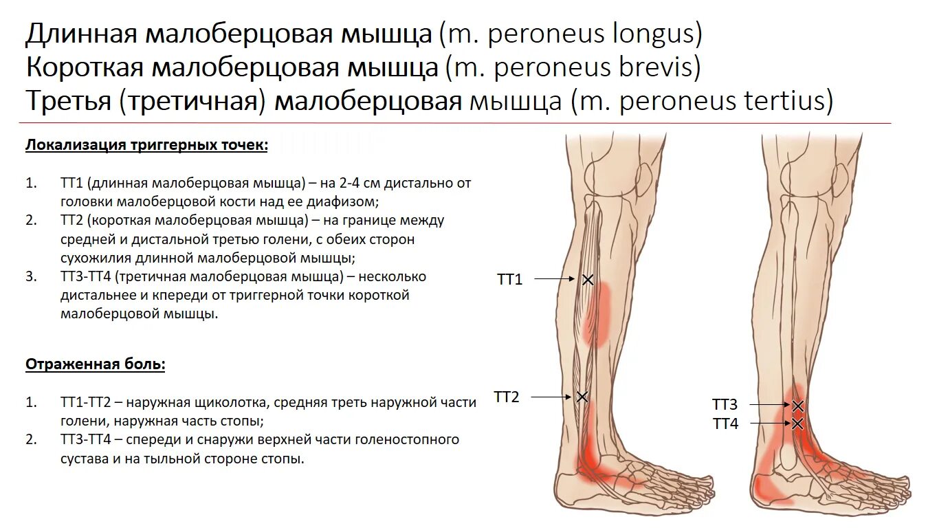 Боль в передней части голени. Триггерные точки и отраженная боль. Триггерные точки самодиагностика. Триггерные точки голени. Триггерные точки на лодыжке.