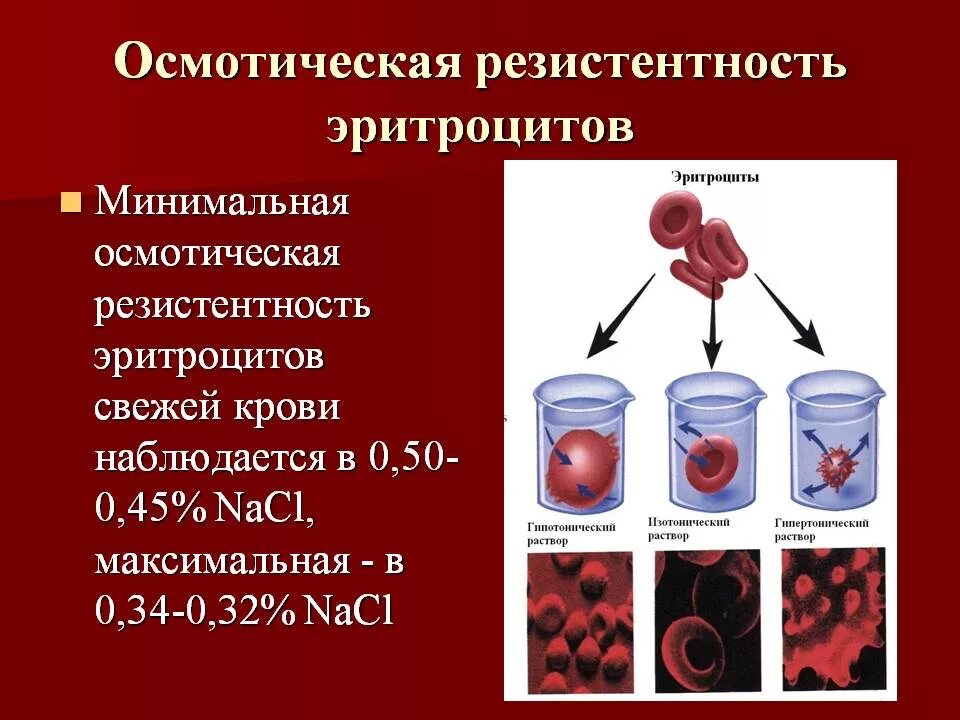 Состояние резистентности. Понятие об осмотической резистентности эритроцитов. Методика исследования осмотической стойкости эритроцитов. Снижение осмотической устойчивости эритроцитов. Исследование осмотической резистентности эритроцитов.